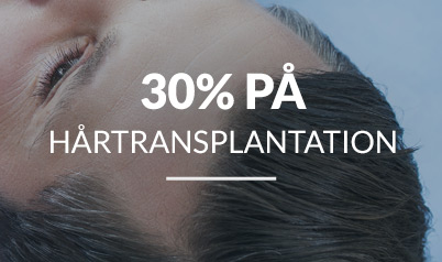 Hårtransplantation