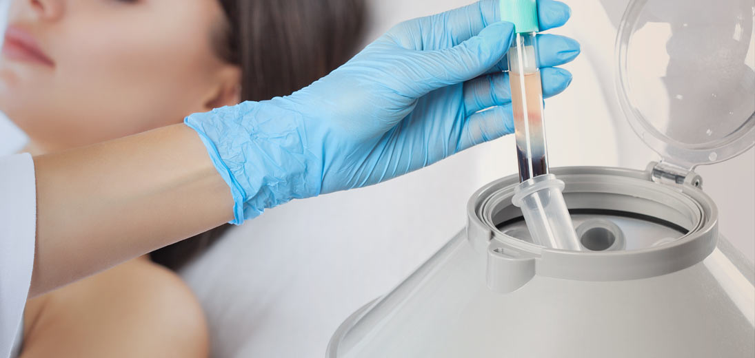 Plasmaprodukter i æstetisk, kosmetisk og anti-aging medicin - en effektiv og sikker metode til regenerering.