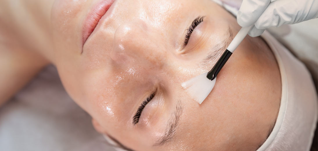 Kemisk peeling - kurus (2+1 dage)
