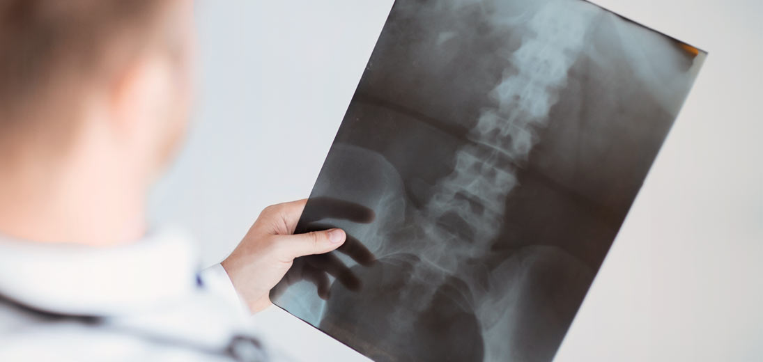 Operationsforløb - rygkirurgi