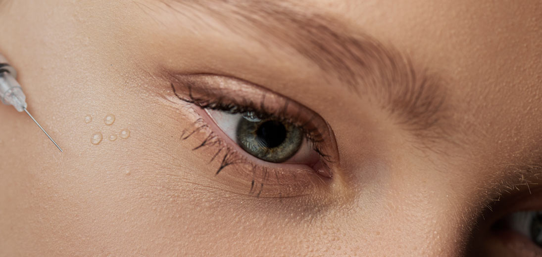 Juvelook® -  Polymælkesyre til øjenregionen