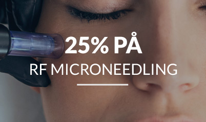 RF microneedling