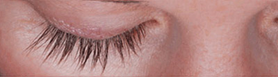Øjenvipper - få kraftigere, længere, tættere behandling hos Kosmetisk hud laserklinik, Aros Privathospital i Aarhus