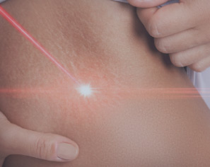 IPL (Nordlys) & Fraxel