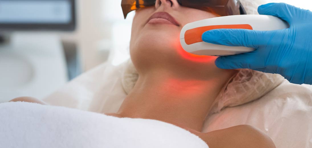 Fraxel laser behandling i Aarhus - til slap hud og rynker