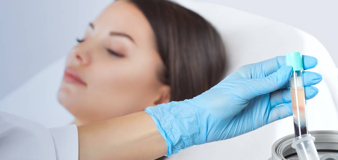 PRP & PRF behandling  - stimulerer hudens celleforyngelse 