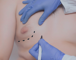 Mandlig brystdannelse